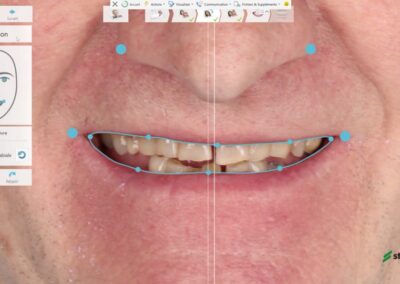 Digital Smile Design